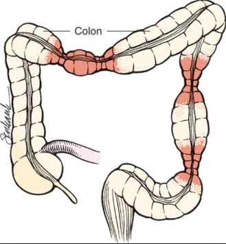 colon and bowel